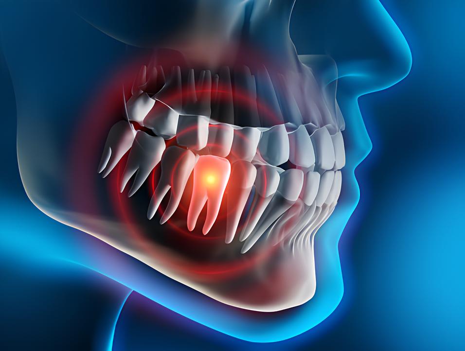Teeth image - Emergency dentist Cobham